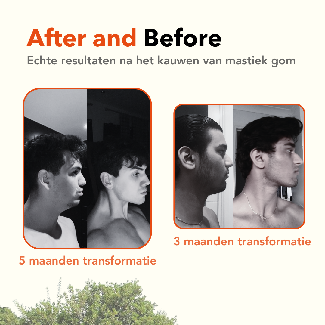 Apollo Mastic Gum® 25g